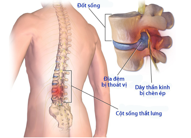 thoat vi dia dem cuoc song that lung 