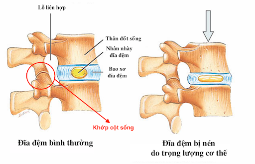 giai phau cot song 