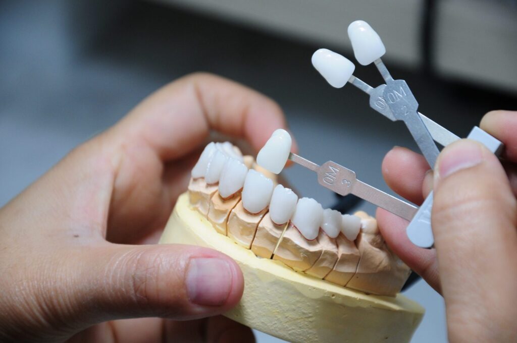 Composite nano - Linh hoạt trong phục hình tạm và lâu dài