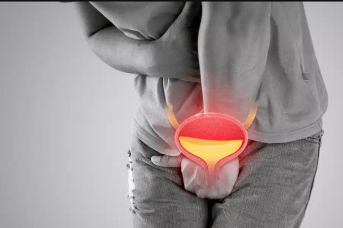 Viêm niệu đạo ở nam giới