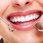 Ứng dụng tiêu biểu của các dòng răng sứ cao cấp