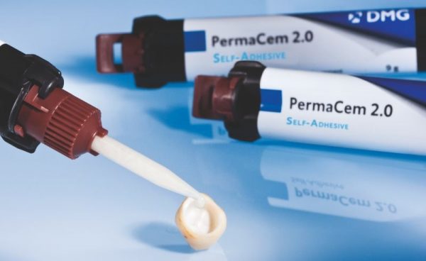 Tiêu chí lựa chọn xi măng trám răng