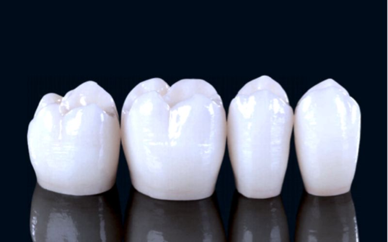 Hình răng sứ Katana bền chắc và sáng bóng