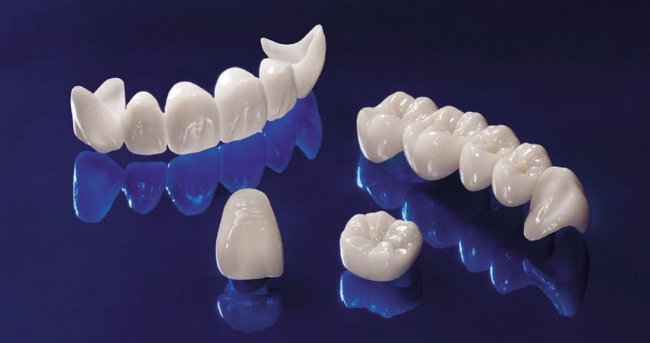 Các loại răng sứ Katana Nhật Bản và ưu nhược điểm