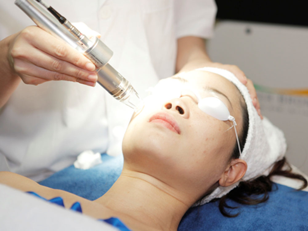 Laser trị sẹo rỗ bị thâm do đâu và cách xử lý